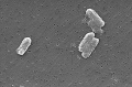 Citrobacter freundii (elektronmikroszkópos felvétel)